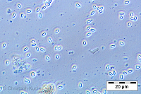 The oval-shaped Nosema spores appear typically bright with dark smooth edges under phase-contrast light microscope (magnification: 400x). 