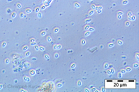 The oval-shaped Nosema spores appear typically bright with dark smooth edges under phase-contrast light microscope (magnification: 400x).